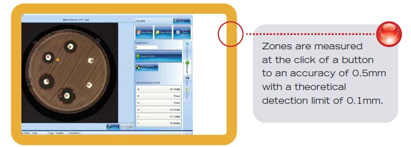 Automatic Colony Counting & Zone Reader